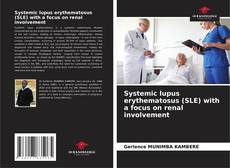Couverture de Systemic lupus erythematosus (SLE) with a focus on renal involvement