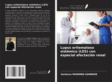 Couverture de Lupus eritematoso sistémico (LES) con especial afectación renal
