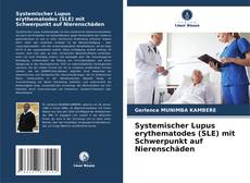 Обложка Systemischer Lupus erythematodes (SLE) mit Schwerpunkt auf Nierenschäden