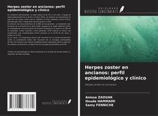 Herpes zoster en ancianos: perfil epidemiológico y clínico kitap kapağı