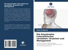 Bookcover of Die Amyotrophe Lateralsklerose verstehen: Ursachen und Management