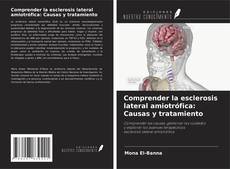 Buchcover von Comprender la esclerosis lateral amiotrófica: Causas y tratamiento
