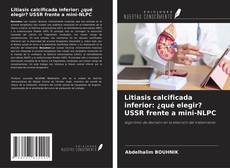 Couverture de Litiasis calcificada inferior: ¿qué elegir? USSR frente a mini-NLPC