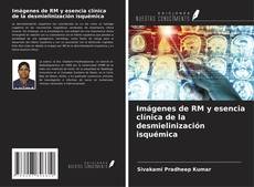 Capa do livro de Imágenes de RM y esencia clínica de la desmielinización isquémica 