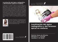 Buchcover von Localización del ápice radiográfico y del foramen apical en molares