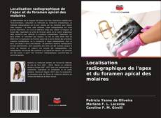 Capa do livro de Localisation radiographique de l'apex et du foramen apical des molaires 