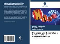 Borítókép a  Diagnose und Behandlung von zerebralen Venenthrombosen - hoz