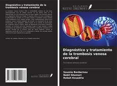 Couverture de Diagnóstico y tratamiento de la trombosis venosa cerebral