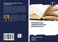 Buchcover von Биомаркеры диабетической ретинопатии