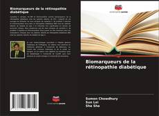 Biomarqueurs de la rétinopathie diabétique kitap kapağı