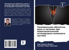 Capa do livro de Синовиальная оболочка, роль и лечение при невоспалительном остеоартрозе коленного сустава 