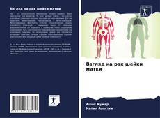 Capa do livro de Взгляд на рак шейки матки 