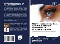 Capa do livro de Послеоперационная боль при PRK с кодеина фосфатом 30 мг/парацетамолом 