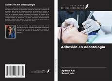 Bookcover of Adhesión en odontología