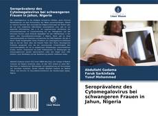 Borítókép a  Seroprävalenz des Cytomegalovirus bei schwangeren Frauen in Jahun, Nigeria - hoz