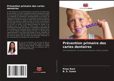 Buchcover von Prévention primaire des caries dentaires