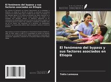 Copertina di El fenómeno del bypass y sus factores asociados en Etiopía