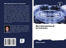 Bookcover of Дистракционный остеогенез
