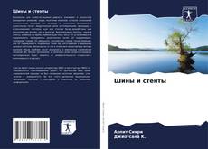 Bookcover of Шины и стенты