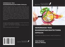 Buchcover von HEMORRAGIA TRAS DUODENOPANCREATECTOMÍA CEFÁLICA