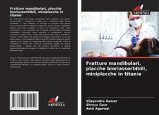 Buchcover von Fratture mandibolari, placche bioriassorbibili, miniplacche in titanio