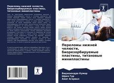 Buchcover von Переломы нижней челюсти, биорезорбируемые пластины, титановые минипластины