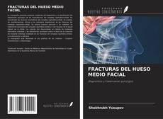 Couverture de FRACTURAS DEL HUESO MEDIO FACIAL