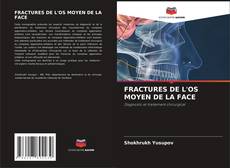 Capa do livro de FRACTURES DE L'OS MOYEN DE LA FACE 