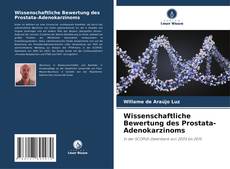 Borítókép a  Wissenschaftliche Bewertung des Prostata-Adenokarzinoms - hoz