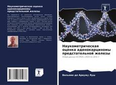 Buchcover von Наукометрическая оценка аденокарциномы предстательной железы