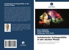 Capa do livro de Ischämische Schlaganfälle in der akuten Phase 