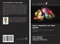 Couverture de Ictus isquémico en fase aguda