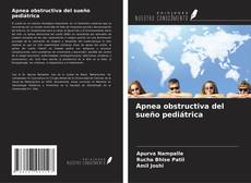 Couverture de Apnea obstructiva del sueño pediátrica