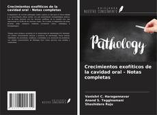 Couverture de Crecimientos exofíticos de la cavidad oral - Notas completas