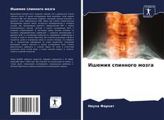 Buchcover von Ишемия спинного мозга