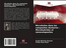 Capa do livro de Microfuites dans les composites dentaires : Microhybrides et nanocomposites 