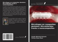 Couverture de Microfugas en composites dentales: Microhíbridos frente a nanocomposites