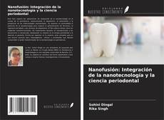 Couverture de Nanofusión: Integración de la nanotecnología y la ciencia periodontal