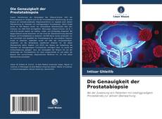 Capa do livro de Die Genauigkeit der Prostatabiopsie 