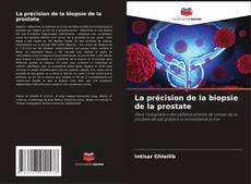 Capa do livro de La précision de la biopsie de la prostate 