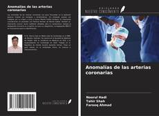 Couverture de Anomalías de las arterias coronarias