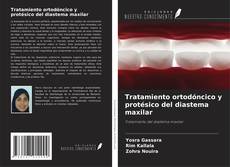 Couverture de Tratamiento ortodóncico y protésico del diastema maxilar