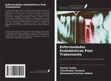 Enfermedades Endodónticas Post Tratamiento的封面
