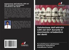 Buchcover von Valutazione dell'attività LDH nel GCF durante il movimento ortodontico dei denti