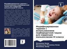 Portada del libro de Модифицированная терапия с использованием подбородочной чашки для коррекции мальокклюзии III класса