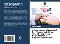 Capa do livro de Schwangerschaftsverlauf bei Frauen, bei denen eine idiopathische Polyhydramnie diagnostiziert wurde 