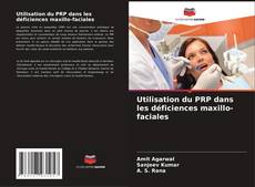 Couverture de Utilisation du PRP dans les déficiences maxillo-faciales