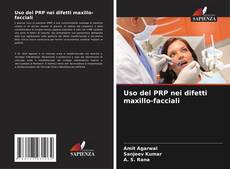 Uso del PRP nei difetti maxillo-facciali kitap kapağı