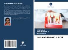 Buchcover von IMPLANTAT-OKKLUSION