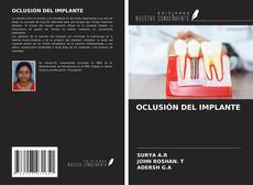 Couverture de OCLUSIÓN DEL IMPLANTE